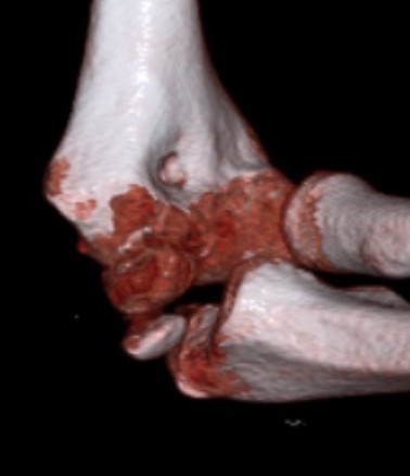 med epi