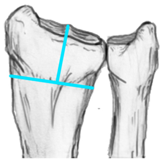Type III