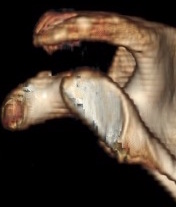 DTA