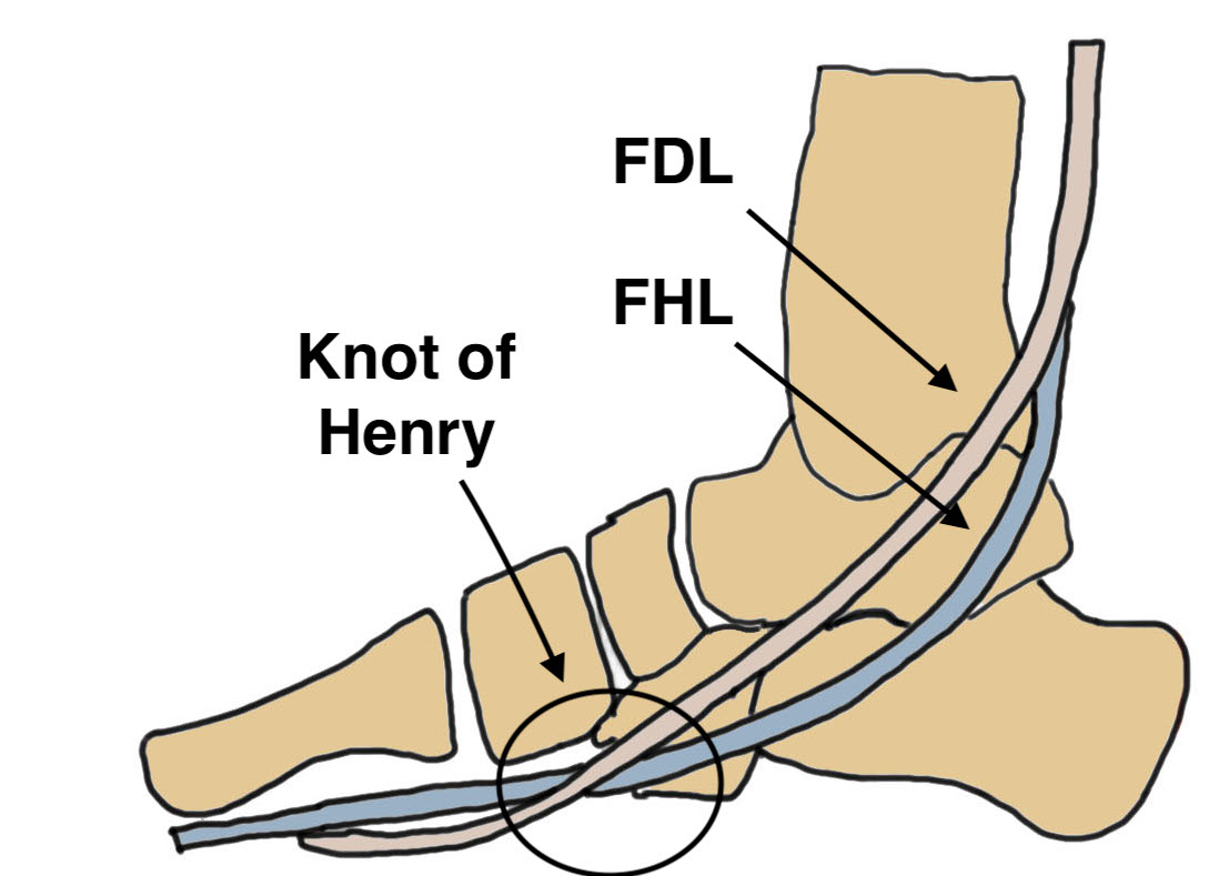 Knot of Henry