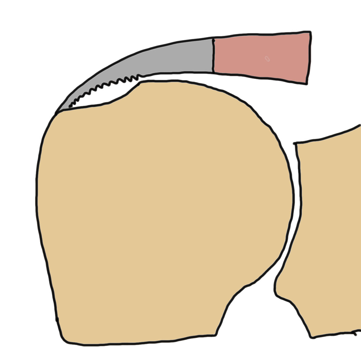 partial