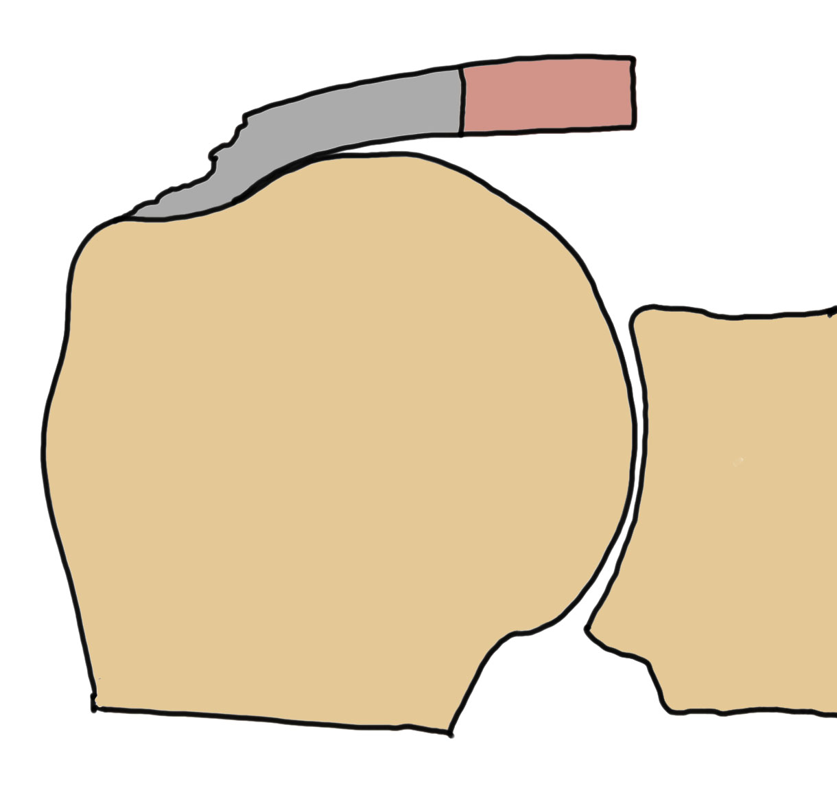 partial