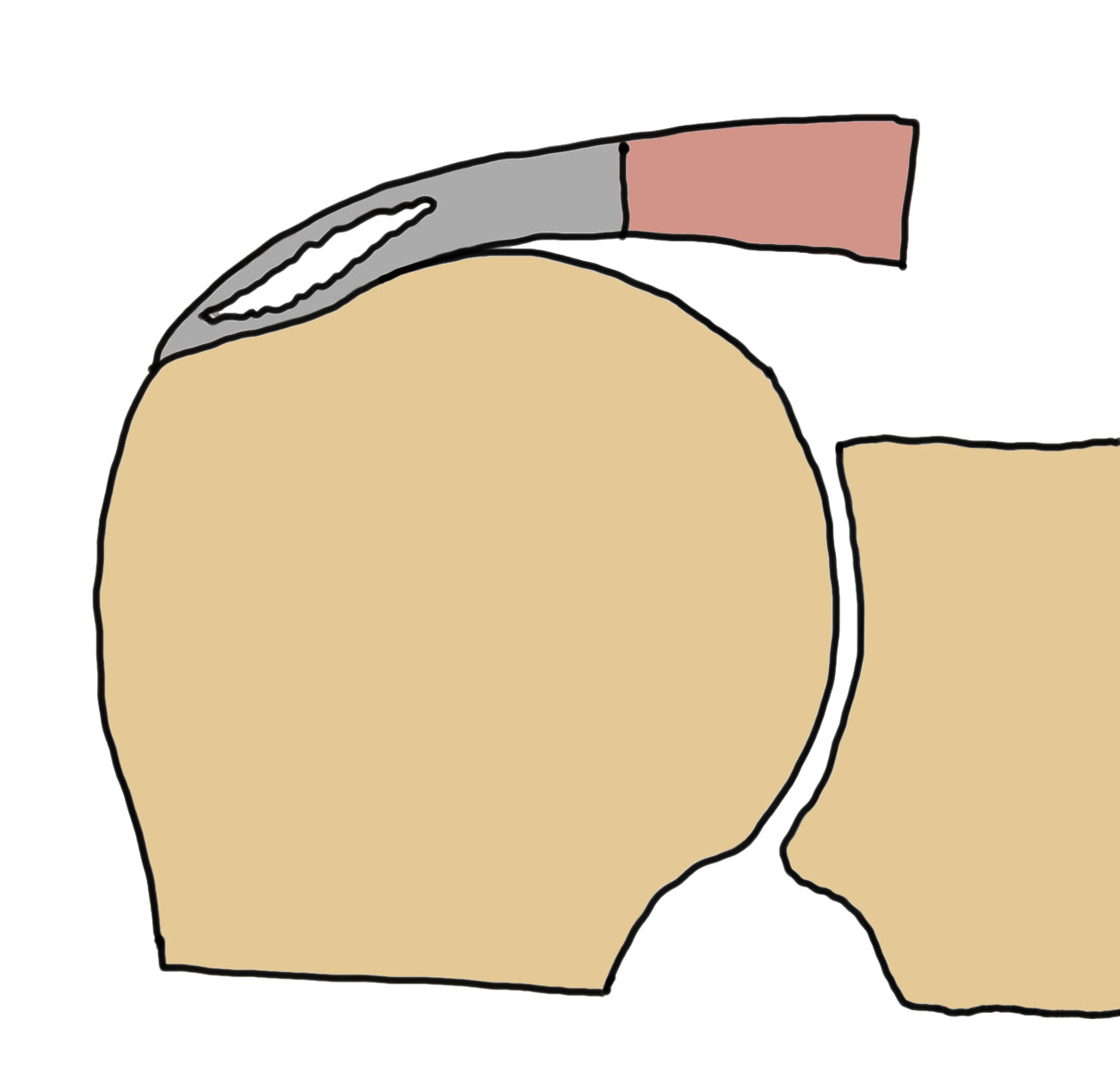 partial