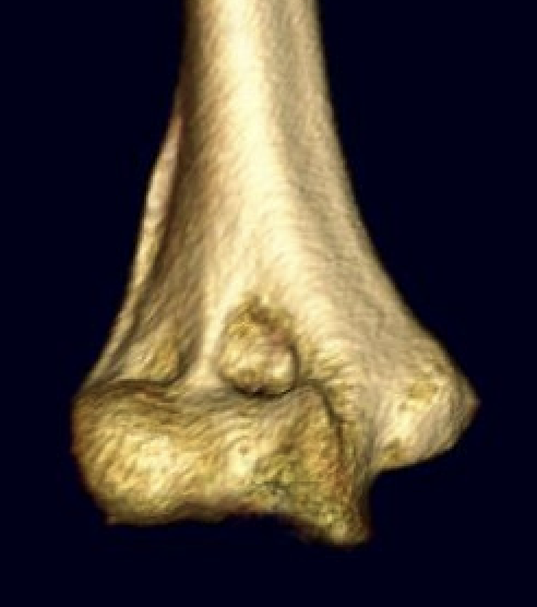 humerus