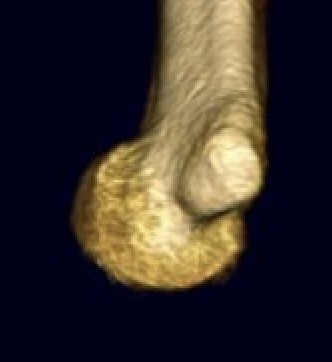 humerus