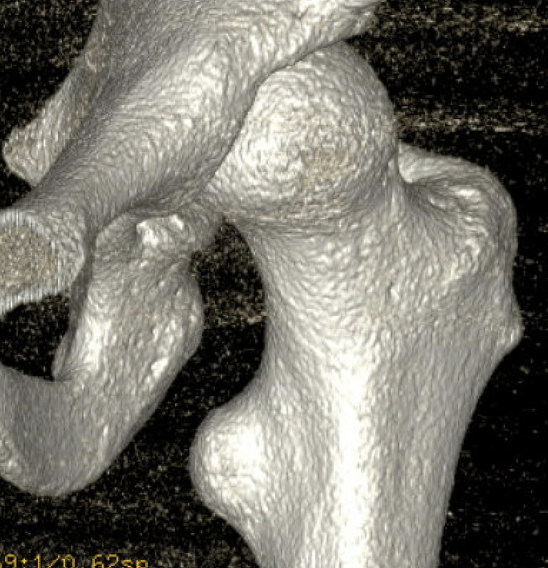 IFI