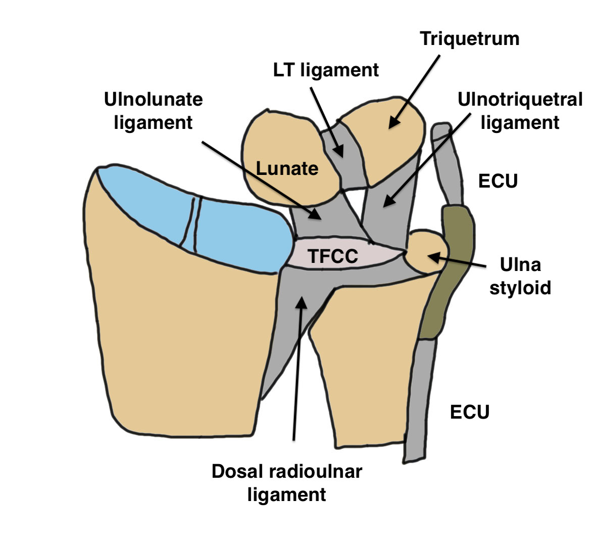 TFCC