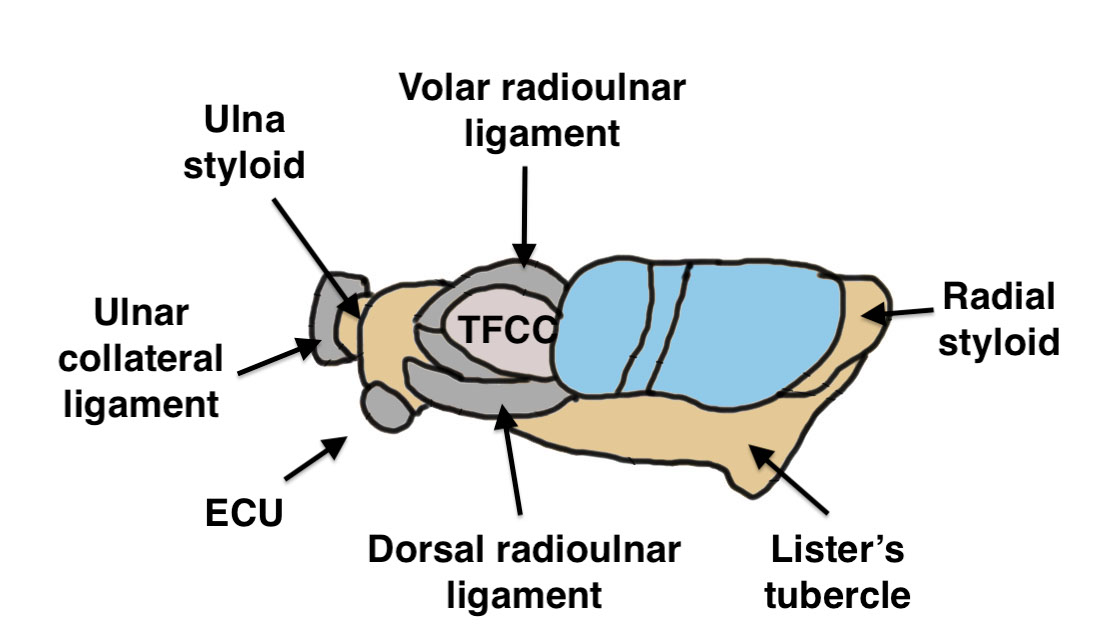 TFCC
