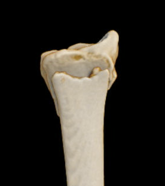 extraarticular
