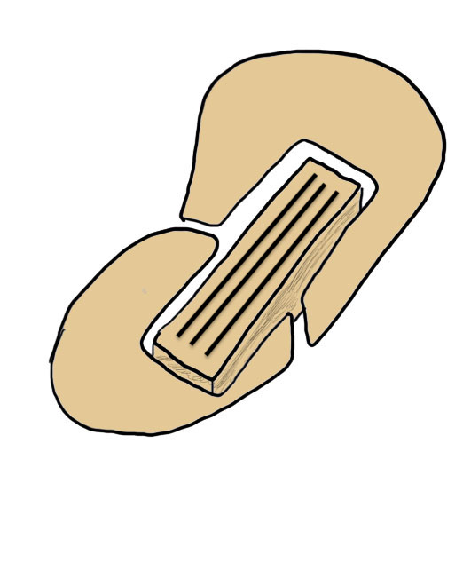 Inlay