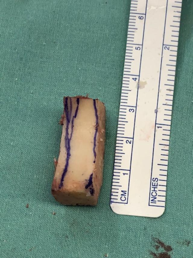 DTA
